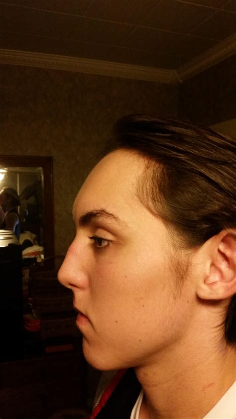 advice   hairstyle  large forehead