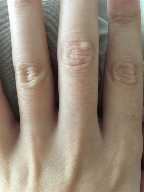 cut finger very painful 7