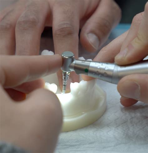 Implant courses - Socket Preservation - ACE Courses - Dental Courses