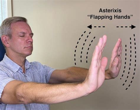 What is Asterixis? - Sentinel Nurse