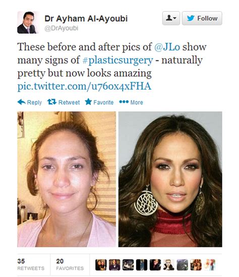 Jennifer Lopez slams surgery claims | Stuff.co.nz