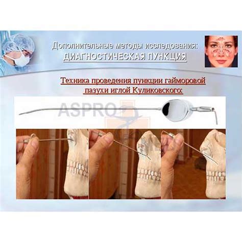 Игла Куликовского для прокола гайморовой полости купить в интернет ...
