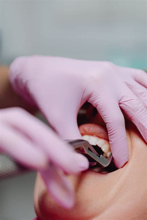 What Are the Symptoms and Treatment of Gum Disease?