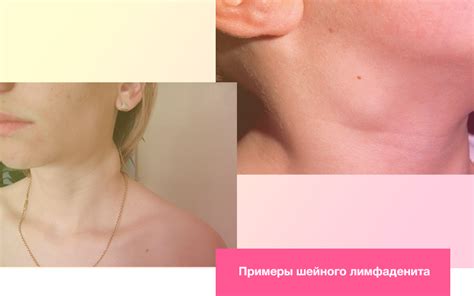 Здоровье