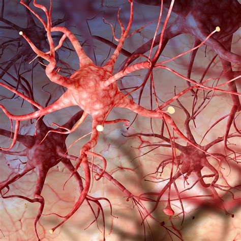 Neurofibromatosis Type 3