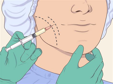face dimples types 6