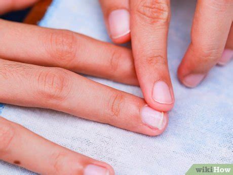 3 Ways to Prevent Hangnails - wikiHow Health