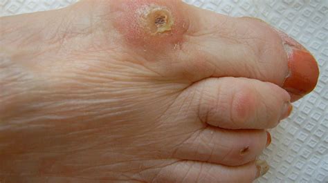 Raised Skin Bumps: Pictures, Types, Causes, and Treatment