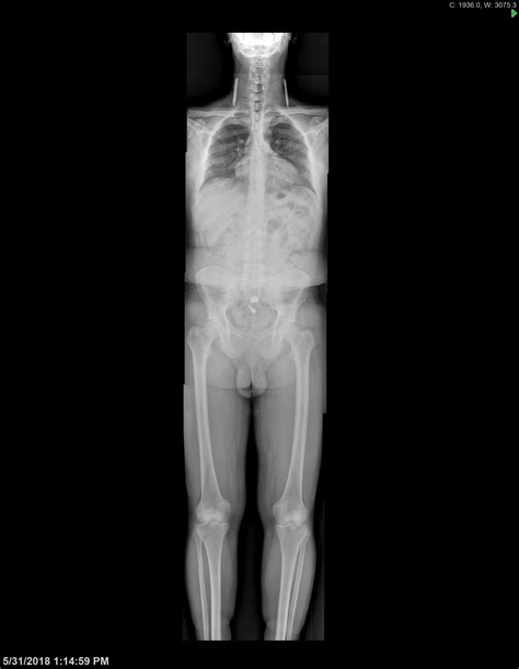 Musculoskeletal Radiology - University Diagnostic Medical Imaging