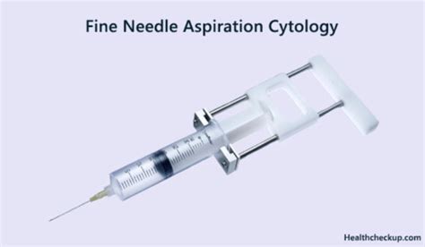 Fine Needle Aspiration Cytology: Preparation, Procedure, Results