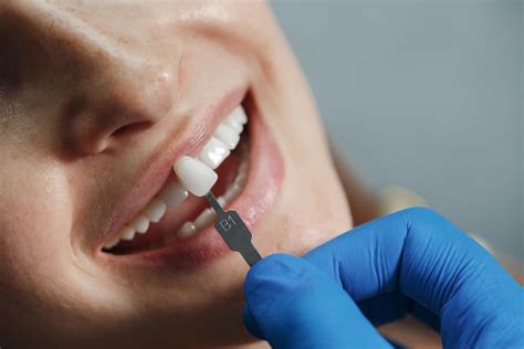 Коронки для зубов Турция стоимость в Elara Medical - Коронки для зубов ...