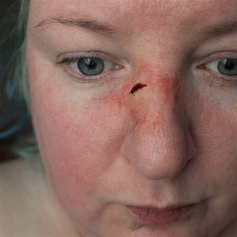 Broken Nose Prosthetic // Encapsulated Silicone Appliance // Beaten Up