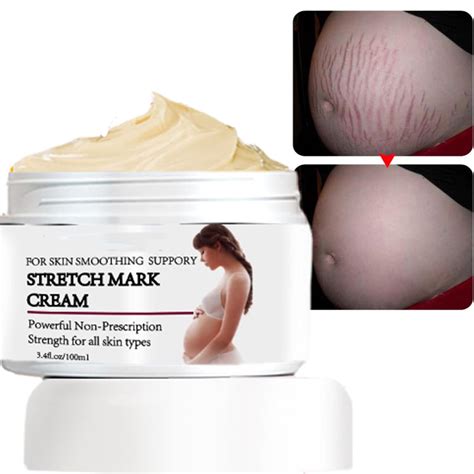 Amazon.com : Rosarden Stretch Mark Prevention Cream for Pregnancy