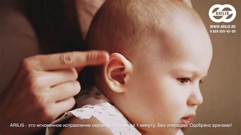Детские ушные корректоры для исправления лопоухости Арилис - YouTube
