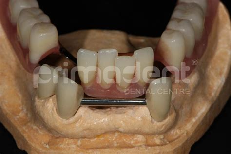 :: PrimaDent