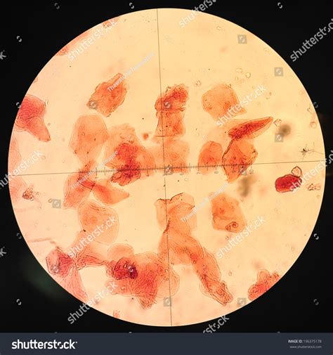 9 Herpes Gingiva Royalty-Free Images, Stock Photos & Pictures