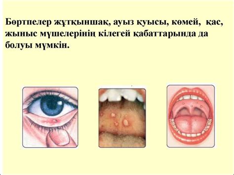 Желшешек - презентация онлайн
