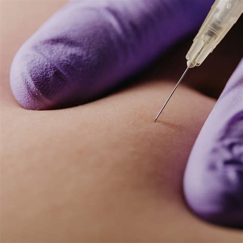 Free picture: syringe, injection, needle, anesthetic, skin, gloves
