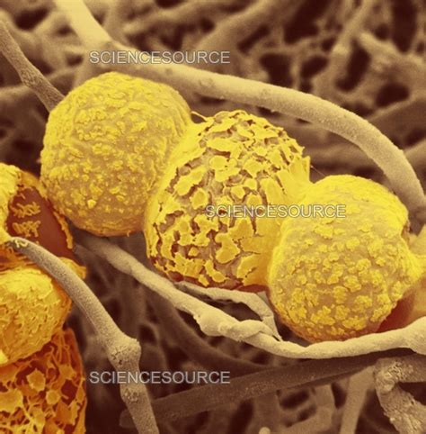 rhizopus sexualis zygospore sem stock image science source images