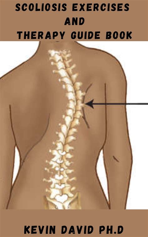 SCOLIOSIS EXERCISES AND THERAPY GUIDE BOOK: Step By Step Guide On How