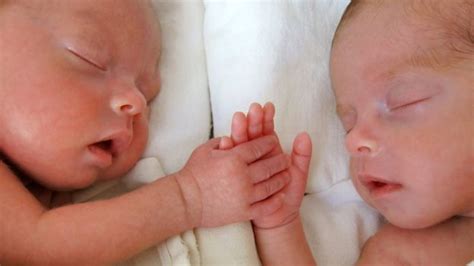 Semi-identical twins 'identified for only the second time' - Sutured