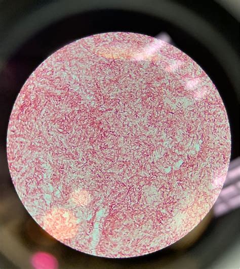 solved endospore stain positive  negativeendospore stain cheggcom