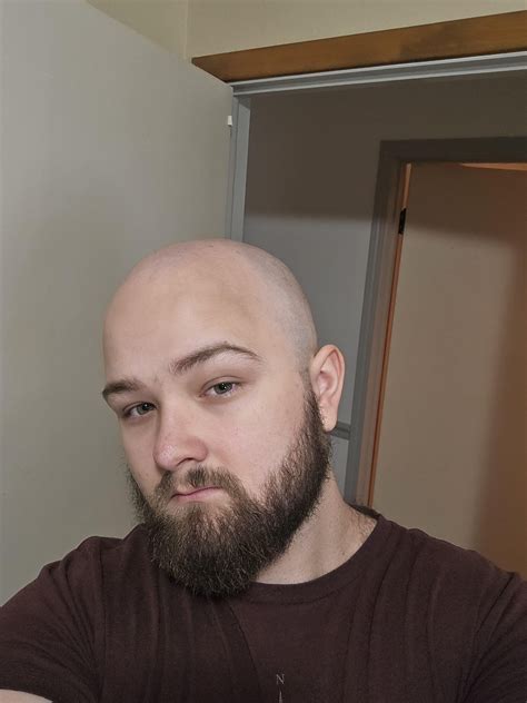 Bit the bullet today at 22 : r/bald