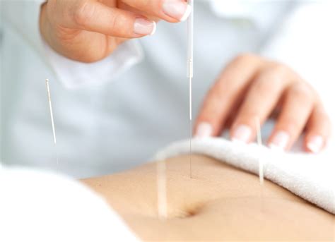 ACUPUNTURA PARA EL DOLOR - Healthy Space