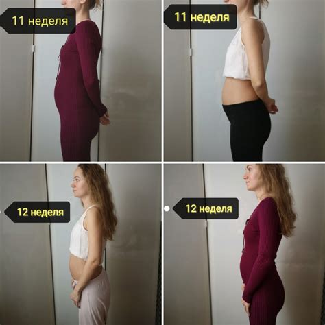 17 неделя. Метаморфозы моего тела. — 5 ответов | форум Babyblog