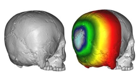 Ancient humans deformed their skulls for sake of ‘group identity ...