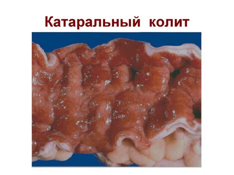 Кишечные инфекции - презентация онлайн
