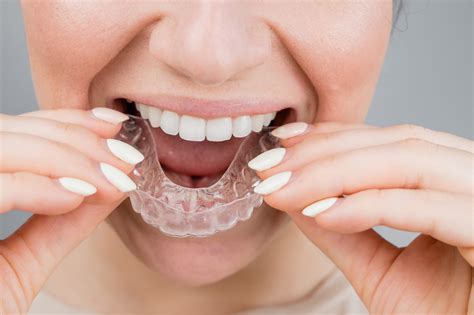 Orthodontics & Orthopedics Treatment in Manton | Dental Clinic Near You