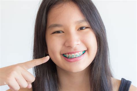 Accelerated Orthodontics - Yang Orthodontics