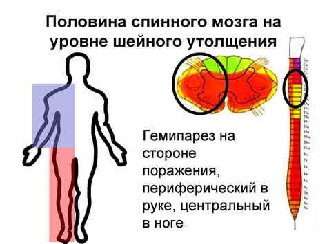 Двигательная сфера. Анатомо-физиологические особенности. Клинические ...