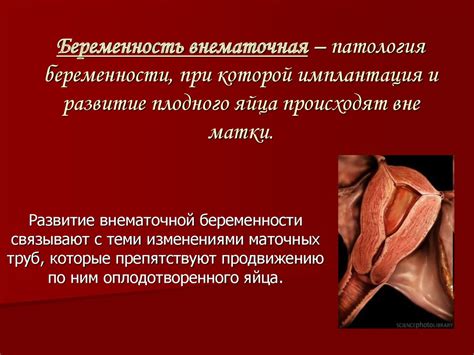 Беременность внематочная - презентация онлайн