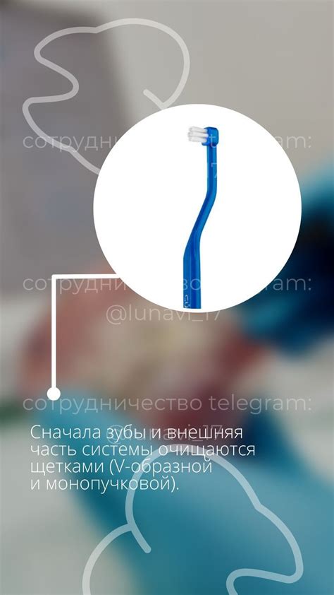 ЗУБЫ | СТОМАТОЛОГИЯ | БРЕКЕТЫ | Сторис для стоматологической клиники ...