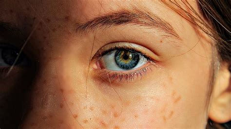 Zeaxanthin: Health Benefits and Top Food Sources