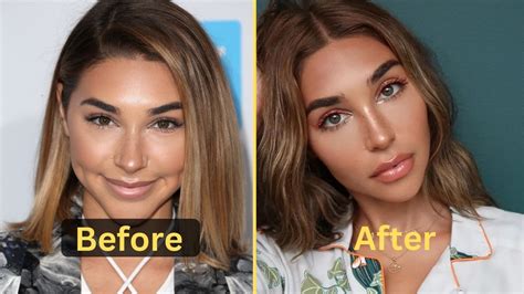 Chantel Jeffries Weight Loss: Diet Plan, Workout, Surgery, Before