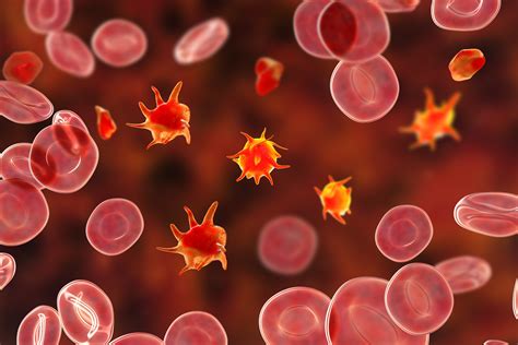 Analyzing Incidence of Primary Immune Thrombocytopenia in England ...