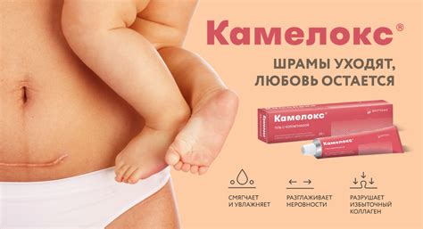 Камелокс | Гель с коллагеназой