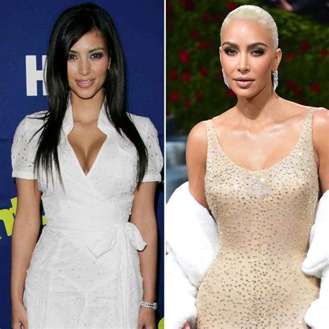 Celebrities Before And After Plastic Surgery