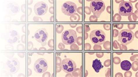 Hematology Laboratory