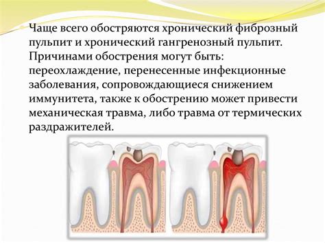 Хронические формы пульпита - презентация онлайн