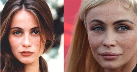 Emmanuelle Béart lanceert campagne tegen plastische chirurgie ...