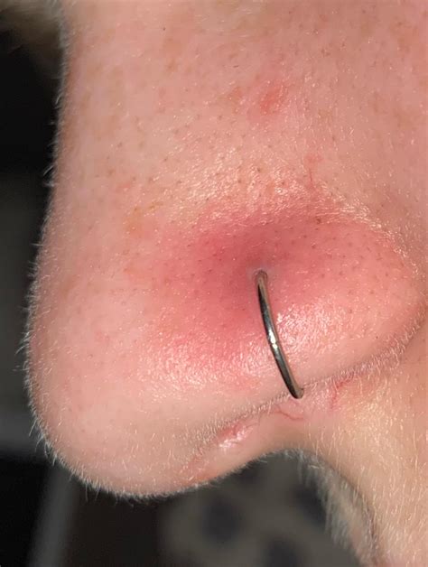 Help! What do i do with my irritated/infected nose piercing? Ive had it