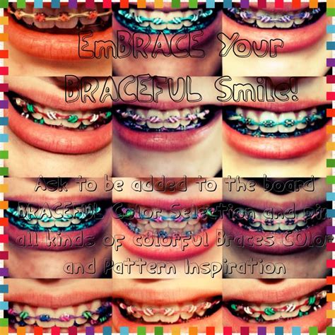 pretty braces colors to get - Katrice Cockrell