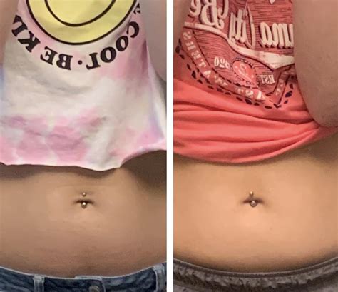 Is my navel piercing healing correctly? I’ve only had it a 1 week 1/2 ...