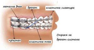 Колко струват брекетите? Цена на метални брекети и скоби | Портал 21