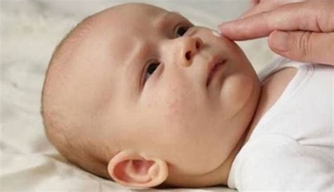 Golden Tips for Baby Skin Care