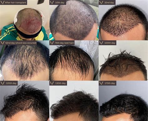 Souirensu: My Unexpected Results After Just One Week! - moegvvi